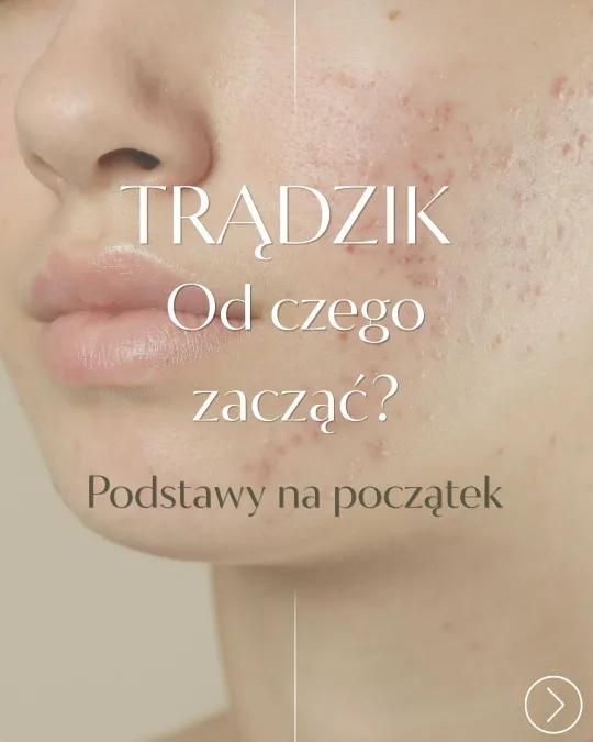 Grafika „Trądzik - od czego zacząć? Podstawy na początek” na tle zbliżenia skóry z wypryskami